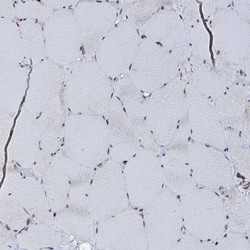 Invitrogen EDC4 Polyclonal Antibody 100 &mu;L | Buy Online | Invitrogen&trade; | Fisher Scientific