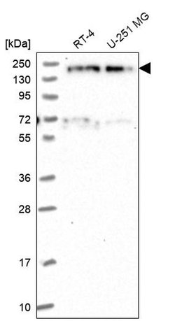 Invitrogen EDC4 Polyclonal Antibody 100 &mu;L | Buy Online | Invitrogen&trade; | Fisher Scientific
