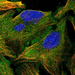 Invitrogen Katanin p80 Polyclonal Antibody 100 &mu;L; Unconjugated:Antibodies,