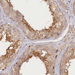 Invitrogen Katanin p80 Polyclonal Antibody 100 &mu;L; Unconjugated:Antibodies,