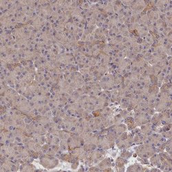 Invitrogen Katanin p80 Polyclonal Antibody 100 &mu;L; Unconjugated:Antibodies,
