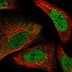 Invitrogen FAAP24 Polyclonal Antibody 100 &mu;L; Unconjugated:Antibodies,