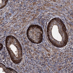 Invitrogen TXNDC11 Polyclonal Antibody 100 &mu;L; Unconjugated:Antibodies,