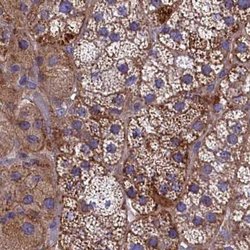 Invitrogen AMDHD2 Polyclonal Antibody 100 &mu;L | Buy Online | Invitrogen&trade; | Fisher Scientific