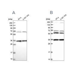 Invitrogen DNAJC17 Polyclonal Antibody 100 &mu;L | Buy Online | Invitrogen&trade; | Fisher Scientific