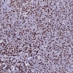 Invitrogen HIST2H2AB Polyclonal Antibody 100 &mu;L; Unconjugated:Antibodies,