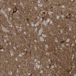 Invitrogen CR16 Polyclonal Antibody 100 &mu;L; Unconjugated:Antibodies,
