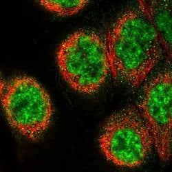 Invitrogen CP070 Polyclonal Antibody 100 &mu;L; Unconjugated:Antibodies,