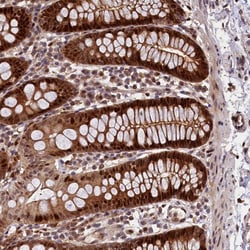 Invitrogen CP070 Polyclonal Antibody 100 &mu;L; Unconjugated:Antibodies,