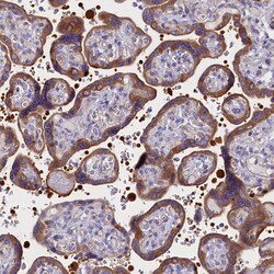 Invitrogen PPP1R13L Polyclonal Antibody 100 &mu;L; Unconjugated:Antibodies,