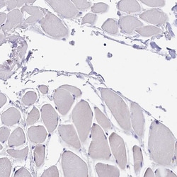 Invitrogen PPP1R13L Polyclonal Antibody 100 &mu;L; Unconjugated:Antibodies,
