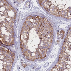 Invitrogen PPP1R13L Polyclonal Antibody 100 &mu;L; Unconjugated:Antibodies,