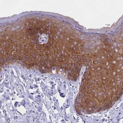 Invitrogen PPP1R13L Polyclonal Antibody 100 &mu;L; Unconjugated:Antibodies,