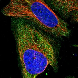 Invitrogen ZSWIM8 Polyclonal Antibody 100 &mu;L; Unconjugated:Antibodies,
