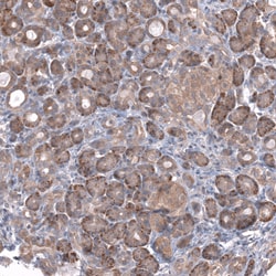 Invitrogen ZSWIM8 Polyclonal Antibody 100 &mu;L; Unconjugated:Antibodies,