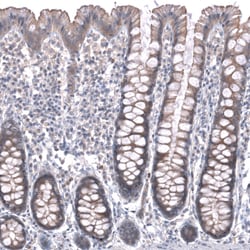 Invitrogen ZSWIM8 Polyclonal Antibody 100 &mu;L; Unconjugated:Antibodies,