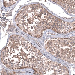 Invitrogen ZSWIM8 Polyclonal Antibody 100 &mu;L; Unconjugated:Antibodies,