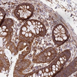 Invitrogen NUDT8 Polyclonal Antibody 100 &mu;L; Unconjugated:Antibodies,