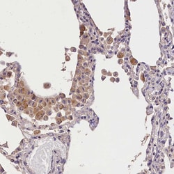 Invitrogen OAS3 Polyclonal Antibody 100 &mu;L; Unconjugated:Antibodies,