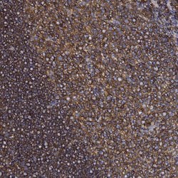 Invitrogen beta Actin Polyclonal Antibody 100 &mu;L; Unconjugated:Antibodies,