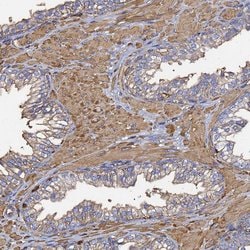 Invitrogen beta Actin Polyclonal Antibody 100 &mu;L; Unconjugated:Antibodies,