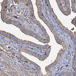 Invitrogen beta Actin Polyclonal Antibody 100 &mu;L; Unconjugated:Antibodies,
