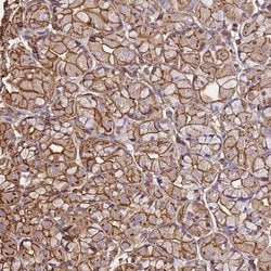 Invitrogen beta Actin Polyclonal Antibody 100 &mu;L; Unconjugated:Antibodies,