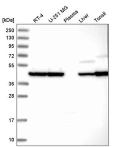 Invitrogen beta Actin Polyclonal Antibody 100 &mu;L; Unconjugated:Antibodies,