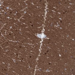 Invitrogen Cerebellin 3 Polyclonal Antibody 100 &mu;L; Unconjugated:Antibodies,