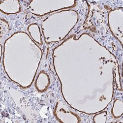 Invitrogen HnRNP Q Polyclonal Antibody 100 &mu;L | Buy Online | Invitrogen&trade; | Fisher Scientific
