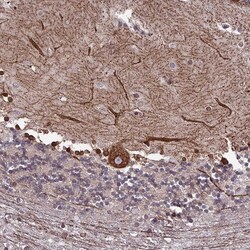 Invitrogen PTCHD4 Polyclonal Antibody 100 &mu;L; Unconjugated:Antibodies,