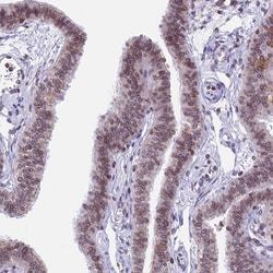 Invitrogen PTCHD4 Polyclonal Antibody 100 &mu;L; Unconjugated:Antibodies,
