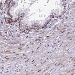 Invitrogen PTCHD4 Polyclonal Antibody 100 &mu;L; Unconjugated:Antibodies,