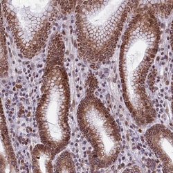 Invitrogen PTCHD4 Polyclonal Antibody 100 &mu;L; Unconjugated:Antibodies,