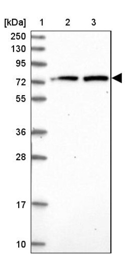 Invitrogen KBTBD8 Polyclonal Antibody 100 &mu;L | Buy Online | Invitrogen&trade; | Fisher Scientific