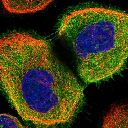 Invitrogen Coronin 2A Polyclonal Antibody 100 &mu;L | Buy Online | Invitrogen&trade; | Fisher Scientific