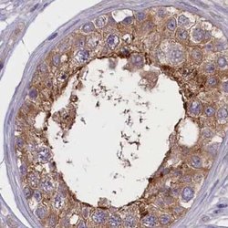 Invitrogen Coronin 2A Polyclonal Antibody 100 &mu;L | Buy Online | Invitrogen&trade; | Fisher Scientific