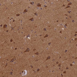 Invitrogen BICD1 Polyclonal Antibody 100 &mu;L; Unconjugated:Antibodies,