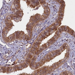 Invitrogen BICD1 Polyclonal Antibody 100 &mu;L; Unconjugated:Antibodies,
