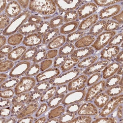 Invitrogen BICD1 Polyclonal Antibody 100 &mu;L; Unconjugated:Antibodies,