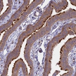 Invitrogen GAS8 Polyclonal Antibody 100 &mu;L; Unconjugated:Antibodies,