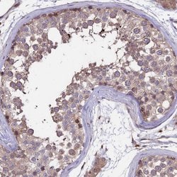 Invitrogen GAS8 Polyclonal Antibody 100 &mu;L; Unconjugated:Antibodies,