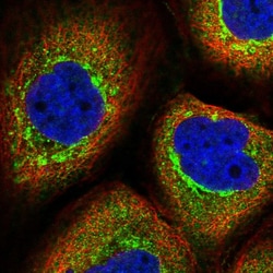Invitrogen TMCO7 Polyclonal Antibody 100 &mu;L; Unconjugated:Antibodies,