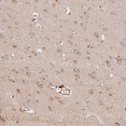 Invitrogen TMCO7 Polyclonal Antibody 100 &mu;L; Unconjugated:Antibodies,