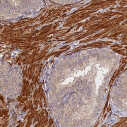 Invitrogen TMCO7 Polyclonal Antibody 100 &mu;L; Unconjugated:Antibodies,