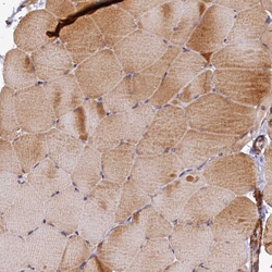 Invitrogen TMCO7 Polyclonal Antibody 100 &mu;L; Unconjugated:Antibodies,
