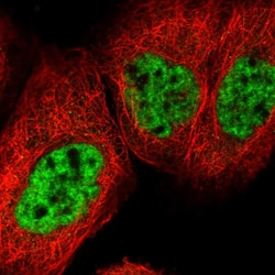 Invitrogen ZC3H18 Polyclonal Antibody 100 &mu;L; Unconjugated:Antibodies,