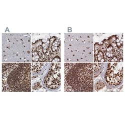 Invitrogen ZC3H18 Polyclonal Antibody 100 &mu;L; Unconjugated:Antibodies,