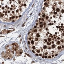 Invitrogen ZC3H18 Polyclonal Antibody 100 &mu;L; Unconjugated:Antibodies,