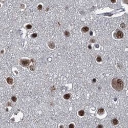 Invitrogen ZC3H18 Polyclonal Antibody 100 &mu;L; Unconjugated:Antibodies,